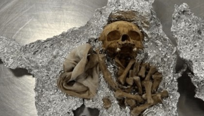 美国机场海关在一乘客行李中查获人类头骨，乘客：是用于举办仪式；官员：存在卫生风险，已没收并销毁